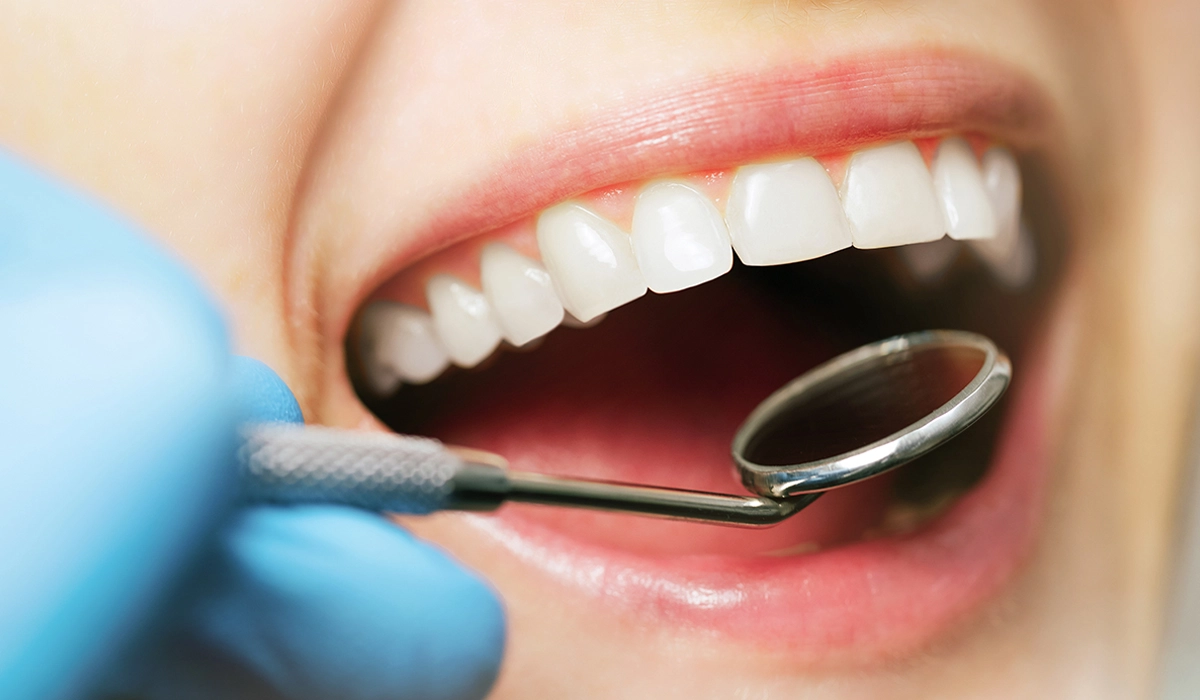 虫歯を予防する