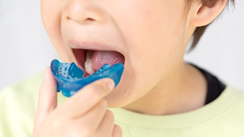 お子様の矯正治療