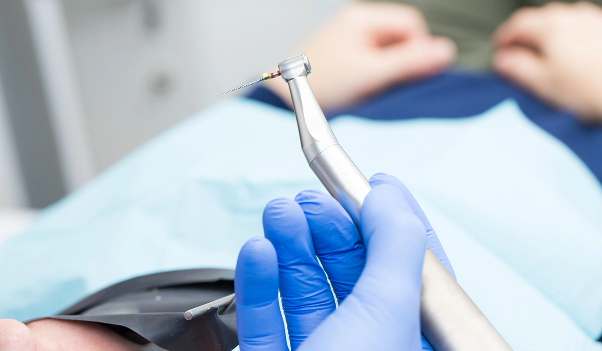 感染した歯髄の除去